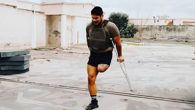 After completing his enlistment in the U.S. Marine Corps, Corporal Neftali Mendoza suffered a ruptured aortic aneurysm caused by untreated PTSD and hypertension stemming from his military service. Doctors had to remove his leg to save his life.