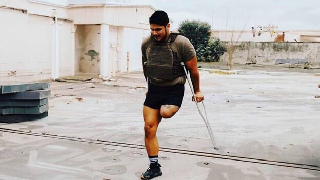 After completing his enlistment in the U.S. Marine Corps, Corporal Neftali Mendoza suffered a ruptured aortic aneurysm caused by untreated PTSD and hypertension stemming from his military service. Doctors had to remove his leg to save his life.